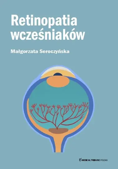 Kup online Retinopatia wcześniaków